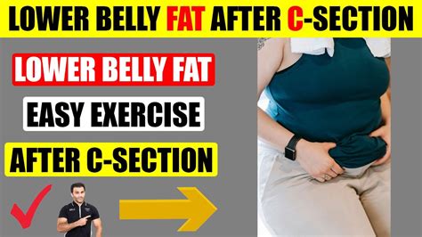 How to Reduce Belly Fat After C-Section After 10 Years: Exploring the Connection Between Time and Transformation